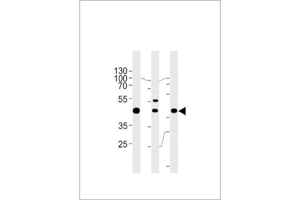 GTF2H2C antibody  (C-Term)