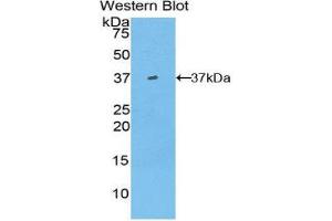 Western Blotting (WB) image for anti-Hepcidin Antimicrobial Peptide (HAMP) (AA 23-82) antibody (ABIN1859135) (Hepcidin antibody  (AA 23-82))