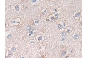 Detection of ATF6 in Human Cerebrum Tissue using Polyclonal Antibody to Activating Transcription Factor 6 (ATF6) (ATF6 antibody  (AA 423-646))