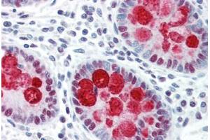 Immunohistochemistry (Paraffin-embedded Sections) (IHC (p)) image for anti-DNA Fragmentation Factor, 45kDa, alpha Polypeptide (DFFA) (AA 2-21) antibody (ABIN461876)