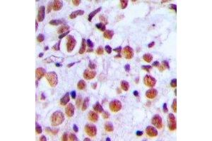 Immunohistochemical analysis of Histone H2A. (H2AFX antibody  (C-Term, pSer139))