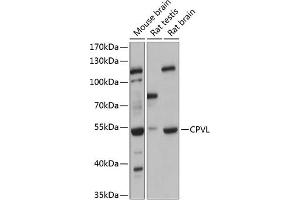 Western blot analysis of extracts of various cell lines, using CPVL antibody (ABIN6130825, ABIN6138985, ABIN6138987 and ABIN6215977) at 1:3000 dilution. (CPVL antibody  (AA 127-476))
