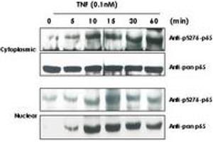 Image no. 3 for anti-Nuclear Factor-kB p65 (NFkBP65) (pSer276) antibody (ABIN1103942) (NF-kB p65 antibody  (pSer276))