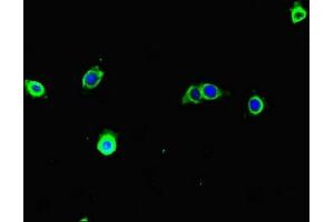Immunofluorescent analysis of A375 cells using ABIN7171680 at dilution of 1:100 and Alexa Fluor 488-congugated AffiniPure Goat Anti-Rabbit IgG(H+L)