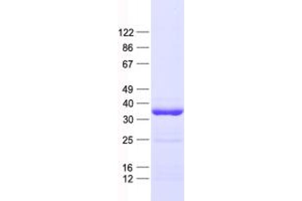 SUPT3H/SPT3 Protein (His tag)