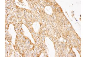 Immunohistochemistry (IHC) image for anti-Insulin Receptor Substrate 2 (IRS2) (AA 1288-1338) antibody (ABIN7453503)