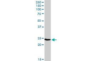 IGLL1 MaxPab rabbit polyclonal antibody. (IGLL1 antibody  (AA 1-213))