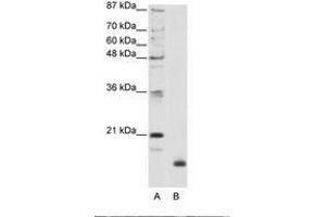 Image no. 1 for anti-Ribosomal Protein L32 (RPL32) (N-Term) antibody (ABIN203010) (RPL32 antibody  (N-Term))