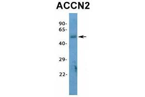 Host:  Rabbit  Target Name:  ACCN2  Sample Type:  Human Fetal Heart  Antibody Dilution:  1. (ASIC1 antibody  (N-Term))