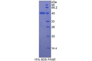 SDS-PAGE (SDS) image for Apolipoprotein E (APOE) (AA 19-168) protein (His tag,GST tag) (ABIN2122443)