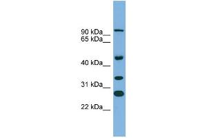 WB Suggested Anti-ASPH Antibody Titration:  0. (Aspartate beta Hydroxylase antibody  (N-Term))