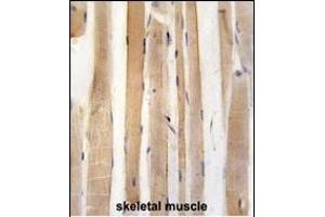Formalin-fixed and paraffin-embedded human skeletal muscle tissue reacted with Autophagy G4A Antibody (C-term) 1808c , which was peroxidase-conjugated to the secondary antibody, followed by DAB staining. (ATG4A antibody  (AA 363-392))