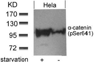 Image no. 1 for anti-Catenin (Cadherin-Associated Protein), alpha 1, 102kDa (CTNNA1) (pSer641) antibody (ABIN401554)