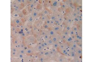 Used in DAB staining on fromalin fixed paraffin- embedded Kidney tissue (MTERF antibody  (AA 1-191))