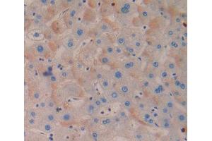 Used in DAB staining on fromalin fixed paraffin- embedded Kidney tissue (MTERF antibody  (AA 1-191))