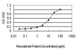 Detection limit for recombinant GST tagged DST is approximately 0. (Dystonin antibody  (AA 401-500))