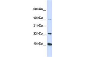 Image no. 1 for anti-Ubiquitin-Conjugating Enzyme E2D 2 (UBE2D2) (N-Term) antibody (ABIN6743143) (UBE2D2 antibody  (N-Term))