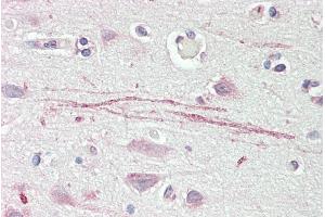 ABIN2613387 (5µg/ml) staining of paraffin embedded Human Cortex. (ASIC1 antibody  (C-Term))