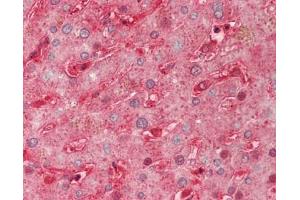 Human Liver: Formalin-Fixed, Paraffin-Embedded (FFPE). (SEMA3A antibody  (AA 31-141) (FITC))