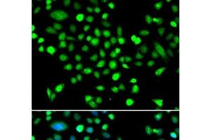 Immunofluorescence analysis of MCF-7 cells using PRKAG1 Polyclonal Antibody (PRKAG1 antibody)