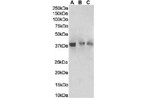 Western Blot using anti-HVEM antibody HMHV-1B18. (Recombinant HVEM antibody)