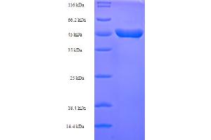 SDS-PAGE (SDS) image for Mannosidase Processing 1 (MAP1) (AA 2-264) protein (His-SUMO Tag) (ABIN5711053) (MAP1 Protein (AA 2-264) (His-SUMO Tag))