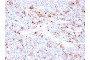 Formalin-fixed, paraffin-embedded human Tonsil stained with S100A8/A9 Complex Recombinant Rabbit Monoclonal Antibody (MAC3157R). (Recombinant S100A8 antibody)