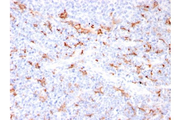 Recombinant S100A8/A9 Complex (Calprotectin) antibody