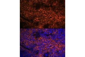 Immunofluorescence analysis of mouse spleen using Hemoglobin subunit alpha (HB) (HB) Rabbit mAb (ABIN7267608) at dilution of 1:100 (40x lens). (HBA1 antibody)