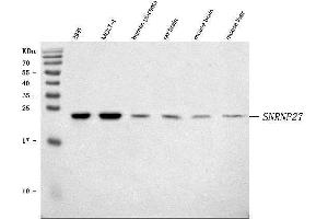 Western blot analysis of SNRNP27 using anti-SNRNP27 antibody (ABIN7599614). (SNRNP27 antibody  (AA 100-155))