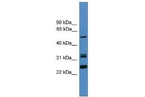 LRRFIP2 antibody used at 0. (LRRFIP2 antibody  (N-Term))
