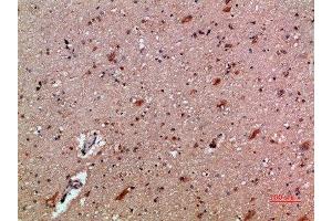 Immunohistochemical analysis of paraffin-embedded human-brain, antibody was diluted at 1:200 (CXCL12 antibody  (AA 31-80))
