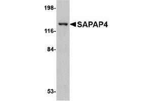 Western Blotting (WB) image for anti-Discs, Large (Drosophila) Homolog-Associated Protein 4 (DLGAP4) (Middle Region) antibody (ABIN1031078) (DLGAP4 antibody  (Middle Region))