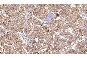 Immunohistochemistry (IHC) image for anti-serpin Peptidase Inhibitor, Clade B (Ovalbumin), Member 5 (SERPINB5) (Internal Region) antibody (ABIN6265008)