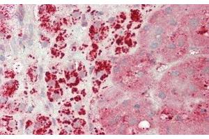 Immunohistochemistry (IHC) image for anti-Galactosidase, alpha (GLA) (AA 81-429) antibody (ABIN7431278)