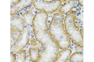 Immunohistochemistry of paraffin-embedded Mouse kidney using ARFGAP1 Polyclonal Antibody at dilution of 1:100 (40x lens). (ARFGAP1 antibody)