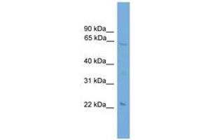 Image no. 1 for anti-EH-Domain Containing 1 (EHD1) (C-Term) antibody (ABIN6744953) (EHD1 antibody  (C-Term))