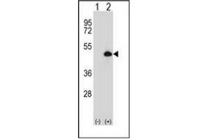 Western blot analysis of CYP20A1 (arrow) using CYP20A1 Antibody (Center) Cat. (CYP20A1 antibody  (Middle Region))