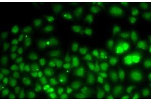 Immunofluorescence analysis of U2OS cells using PCGF6 Polyclonal Antibody (PCGF6 antibody)