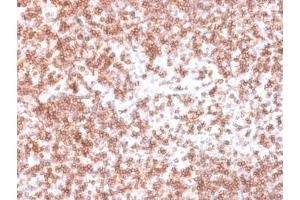 IHC testing of recombinant CD45 antibody and FFPE human lymph node (clone PTPRC/1975R).