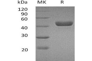 Western Blotting (WB) image for Carbonic Anhydrase 14 (CAR14) (Active) protein (His tag) (ABIN7320478) (Carbonic Anhydrase 14 (CAR14) (Active) protein (His tag))