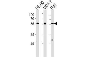 Western Blotting (WB) image for anti-Chromosome 16 Open Reading Frame 71 (C16ORF71) antibody (ABIN3004592) (C16ORF71 antibody)