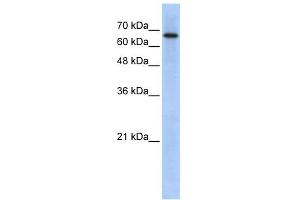WB Suggested Anti-ARHGAP28 Antibody Titration: 0. (ARHGAP28 antibody  (N-Term))