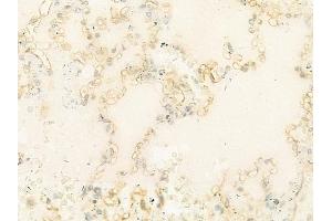 ABIN6263246 and ABIN6274024 at 1/100 staining human normal lung tissue by IHC-P. (MICA antibody  (C-Term))