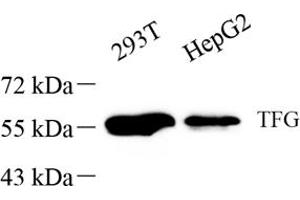 Western blot analysis of TFG (ABIN7076022),at dilution of 1: 1000 (TFG antibody)