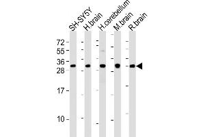 All lanes : Anti-FGF14 Antibody (C-term) at 1:2000 dilution Lane 1: SH-SY5Y whole cell lysates Lane 2: human brain lysates Lane 3: human cerebellum lysates Lane 4: mouse brain lysates Lane 5: rat brain lysates Lysates/proteins at 20 μg per lane. (FGF14 antibody  (C-Term))
