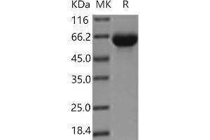 Western Blotting (WB) image for Kin of IRRE Like 3 (KIRREL3) (Active) protein (His tag) (ABIN7321182) (KIRREL3 Protein (His tag))