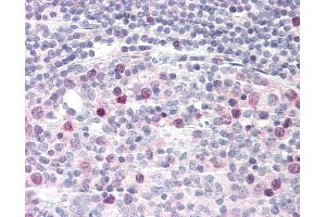 Human Tonsil: Formalin-Fixed, Paraffin-Embedded (FFPE) (TPX2 antibody)