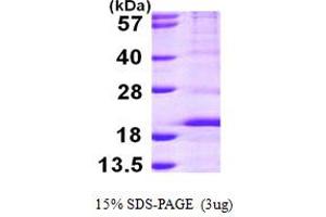 SDS-PAGE (SDS) image for Ribosomal Protein S14 (RPS14) (AA 1-151) protein (His tag) (ABIN667360) (RPS14 Protein (AA 1-151) (His tag))