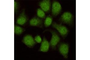 Immunocytochemistry staining of HeLa cells fixed in 1 % Paraformaldehyde and then permeabilized in 0. (WDR77 antibody)